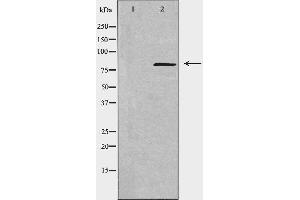 Western blot analysis of extracts from COLO cells, using NCAPH antibody. (NCAPH 抗体  (Internal Region))