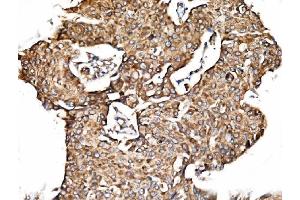 IHC analysis of TIMM29 using anti-TIMM29 antibody (ABIN7601495). (TIMM29 抗体  (AA 37-260))