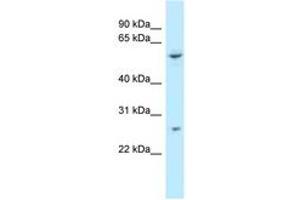 Image no. 1 for anti-Tetratricopeptide Repeat Domain 39B (TTC39B) (AA 378-427) antibody (ABIN6747851) (TTC39B 抗体  (AA 378-427))