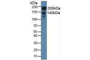 Mouse Detection antibody from the kit in WB with Positive Control: Rat stomach lysate. (Nestin ELISA 试剂盒)