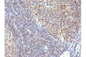 Formalin-fixed, paraffin-embedded human Tonsil stained with IPO38 Monoclonal Antibody (SPM260). (Nuclear Antigen 抗体)