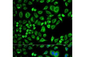 Immunofluorescence analysis of A549 cells using APOD Polyclonal Antibody (Apolipoprotein D 抗体)