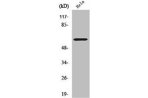 Western Blotting (WB) image for anti-Cytochrome P450, Family 2, Subfamily U, Polypeptide 1 (CYP2U1) (Internal Region) antibody (ABIN7186475)