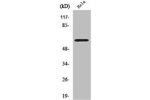 Western Blot analysis of LOVO cells using CYP2U1 Polyclonal Antibody (CYP2U1 抗体  (Internal Region))
