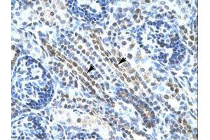 Image no. 1 for anti-Ankyrin Repeat Domain 11 (ANKRD11) (AA 57-106) antibody (ABIN202992) (ANKRD11 抗体  (AA 57-106))