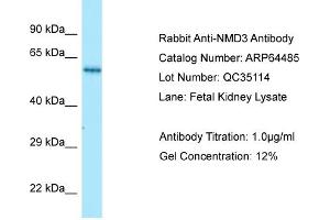 Western Blotting (WB) image for anti-60S Ribosomal Export Protein NMD3 (NMD3) (C-Term) antibody (ABIN2789851) (NMD3 抗体  (C-Term))