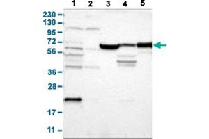 Western Blot analysis with JPH1 polyclonal antibody . (Junctophilin 1 抗体  (AA 387-512))