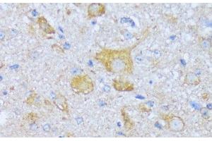 Immunohistochemistry (Paraffin-embedded Sections) (IHC (p)) image for anti-Acyl-CoA Dehydrogenase, Short/branched Chain (ACADSB) antibody (ABIN7258278)