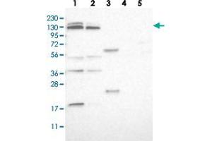 Western blot analysis of Lane 1: RT-4, Lane 2: U-251 MG, Lane 3: Human Plasma, Lane 4: Liver, Lane 5: Tonsil with SLC38A10 polyclonal antibody  at 1:250-1:500 dilution. (SLC38A10 抗体)