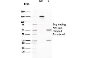 SDS-PAGE Analysis Purified RAD51 Mouse Monoclonal Antibody (RAD51/2765. (RAD51 抗体  (AA 1-134))