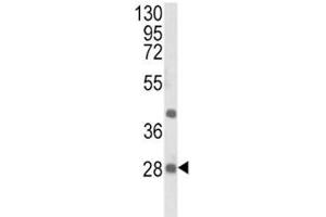 Western blot analysis of EIF4E2 antibody and NCI-H460 lysate. (EIF4E2 抗体)
