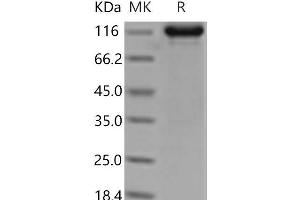 Western Blotting (WB) image for TEK Tyrosine Kinase, Endothelial (TEK) (Active) protein (Fc Tag) (ABIN7321227) (TEK Protein (Fc Tag))