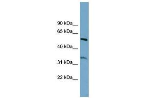 THNSL2 antibody used at 1 ug/ml to detect target protein. (THNSL2 抗体)