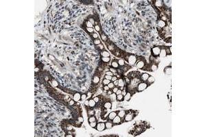 Immunohistochemical staining of human colon with CHN2 polyclonal antibody  shows strong cytoplasmic positivity in granular pattern in glandular cells at 1:20-1:50 dilution. (CHN2 抗体)