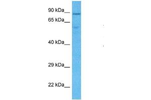 Host:  Rabbit  Target Name:  LETM1  Sample Type:  MDA-MB-435s Whole Cell lysates  Antibody Dilution:  1. (LETM1 抗体  (C-Term))