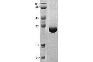 Validation with Western Blot (DCUN1D1 Protein (His tag))