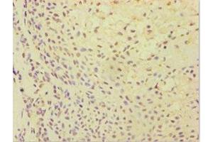 Immunohistochemistry (IHC) image for anti-ATP Synthase, H+ Transporting, Mitochondrial F0 Complex, Subunit F6 (ATP5J) (AA 1-108) antibody (ABIN7144870)