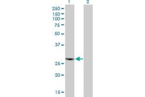 Western Blotting (WB) image for anti-RanBP-Type and C3HC4-Type Zinc Finger Containing 1 (RBCK1) (AA 1-230) antibody (ABIN524041)