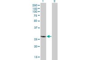 Western Blot analysis of RBCK1 expression in transfected 293T cell line by RBCK1 MaxPab polyclonal antibody. (RBCK1 抗体  (AA 1-230))