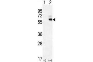 Western Blotting (WB) image for anti-Kininogen 1 (KNG1) antibody (ABIN2996315) (KNG1 抗体)