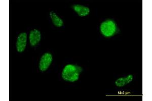 Immunofluorescence of purified MaxPab antibody to IRX2 on HeLa cell. (IRX2 抗体  (AA 1-471))