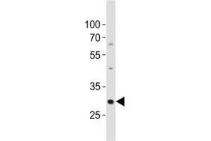 Western blot analysis of lysate from mouse kidney tissue lysate using Hes1 antibody diluted at 1:500.