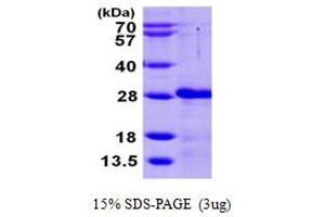 SDS-PAGE (SDS) image for Calcium And Integrin Binding Family Member 2 (CIB2) (AA 1-187) protein (His tag) (ABIN667347) (CIB2 Protein (AA 1-187) (His tag))