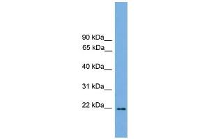 WB Suggested Anti-Jundm2 Antibody Titration:  0. (JDP2 抗体  (C-Term))