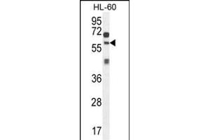 ZSWIM1 Antibody (C-term) (ABIN654558 and ABIN2844265) western blot analysis in HL-60 cell line lysates (35 μg/lane). (ZSWIM1 抗体  (C-Term))