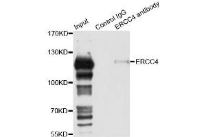 Immunoprecipitation analysis of 150ug extracts of 293T cells using 3ug ERCC4 antibody. (ERCC4 抗体)