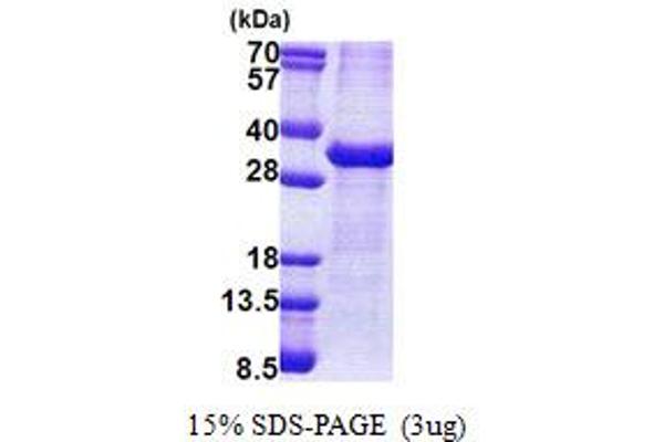 ATP1B1 Protein (AA 63-303) (His tag)
