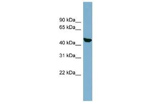 WB Suggested Anti-C22orf28 Antibody Titration: 0. (C22orf28 抗体  (N-Term))