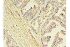 Immunohistochemistry (IHC) image for anti-Solute Carrier Family 25 (Mitochondrial Carrier, Phosphate Carrier), Member 25 (SLC25A25) (AA 1-189) antibody (ABIN7146360)