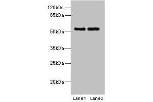 Western blot All lanes: TRIM17 antibody at 1 μg/mL Lane 1: U87 whole cell lysate Lane 2: K562 whole cell lysate Secondary Goat polyclonal to rabbit IgG at 1/10000 dilution Predicted band size: 55, 40 kDa Observed band size: 55 kDa (TRIM17 / RNF16 抗体  (AA 1-300))