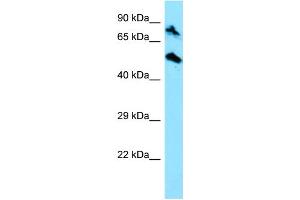 WB Suggested Anti-TOP1MT Antibody Titration: 1. (TOP1MT 抗体  (C-Term))