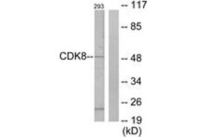 Western blot analysis of extracts from 293 cells, using CDK8 Antibody. (CDK8 抗体  (AA 1-50))