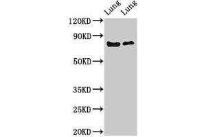 Western Blot Positive WB detected in: Rat lung tissue, Mouse lung tissue All lanes: FOXP1 antibody at 2 μg/mL Secondary Goat polyclonal to rabbit IgG at 1/50000 dilution Predicted band size: 76, 55, 66, 75, 13, 67, 78 kDa Observed band size: 76 kDa (FOXP1 抗体  (AA 541-677))