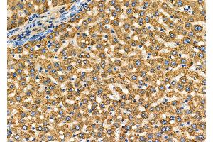 ABIN6261717 and ABIN6278027 at 1/100 staining Rat liver tissue by IHC-P. (FGA 抗体  (C-Term))