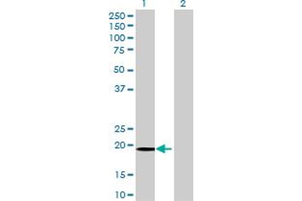 FUNDC2 antibody  (AA 1-189)