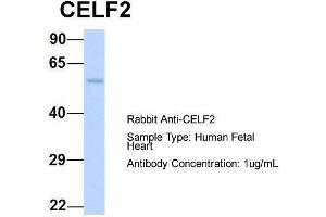Host:  Rabbit  Target Name:  CELF2  Sample Type:  Human Fetal Heart  Antibody Dilution:  1. (CELF2 抗体  (N-Term))
