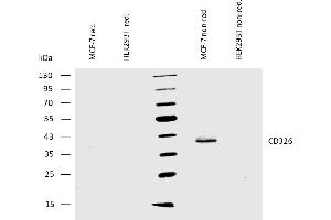 Western blotting analysis of human CD326 using mouse monoclonal antibody VU-1D9 on lysates of MCF-7 cells and HEK293T cells (negative control) under reducing and non-reducing conditions. (EpCAM 抗体)