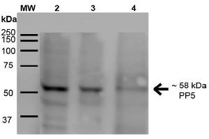 Western Blot analysis of Human A431, HEK293, and Jurkat cell lysates showing detection of ~58 kDa PP5 protein using Mouse Anti-PP5 Monoclonal Antibody, Clone 2E11 . (PP5 抗体  (Alkaline Phosphatase (AP)))