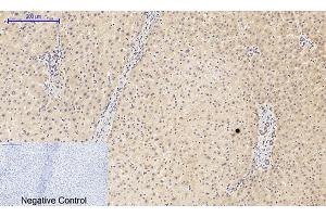 Immunohistochemical analysis of paraffin-embedded human liver tissue. (PIK3R1 抗体  (pTyr607))