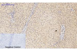 Immunohistochemical analysis of paraffin-embedded human liver tissue. (PIK3R1 抗体  (pTyr607))
