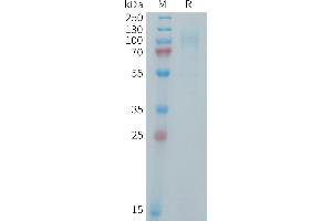 Human IL31RA Protein, His Tag on SDS-PAGE under reducing condition.