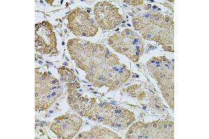 Immunohistochemistry of paraffin-embedded human stomach using PTCD3 antibody. (PTCD3 抗体  (AA 450-689))