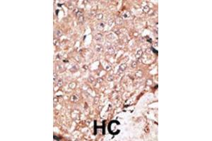 Immunohistochemistry (IHC) image for anti-Lysine (K)-Specific Demethylase 1A (KDM1A) antibody (ABIN2996581) (LSD1 抗体)