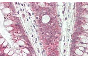 Detection of DDIT3 in Human Colon Tissue using Polyclonal Antibody to DNA Damage Inducible Transcript 3 (DDIT3)