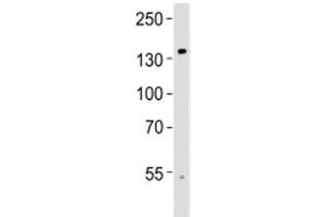 Western Blotting (WB) image for anti-Transient Receptor Potential Cation Channel, Subfamily M, Member 8 (TRPM8) (AA 521-552) antibody (ABIN3029240)