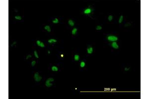 Immunofluorescence of monoclonal antibody to CHEK2 on HeLa cell. (CHEK2 抗体  (AA 1-543))